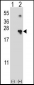 NME4 Antibody (N-term)
